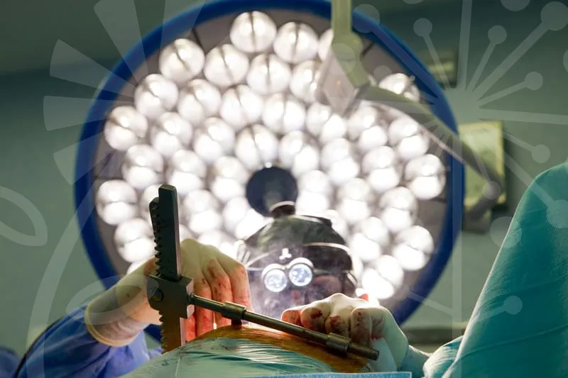 비중격만곡증수술