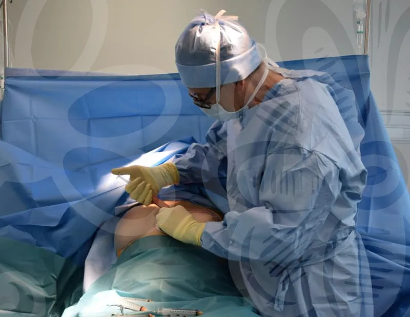 비중격만곡증수술