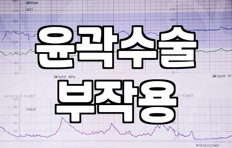 안면윤곽후기 확인 시 주의해야 할 광고성 정보와 실제 수술 범위